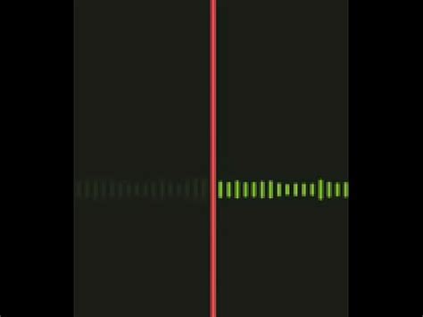 Escuchando A Vecina Gritona XVIDEOS