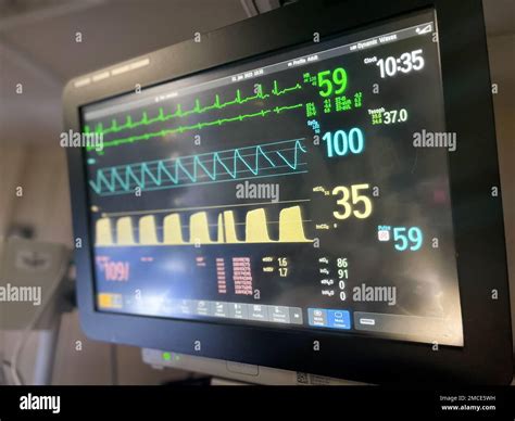 Hospital Monitors Electrocardiogram Pulse Blood Pressure Anesthesia