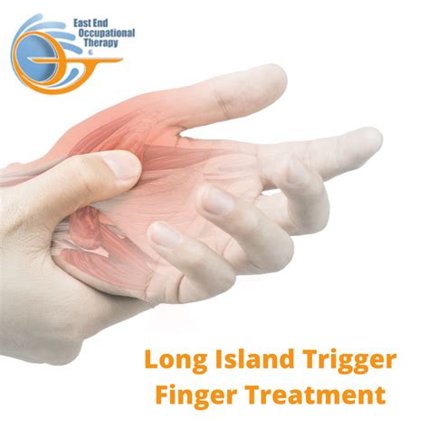 Long Island Trigger Finger Treatment - East End Occupational Therapy