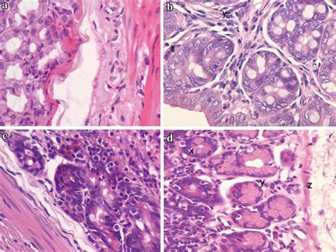 HE-stained pathological sections of ileum and colon (200×). a, b... | Download Scientific Diagram