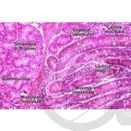 Uomo Intestino Tenue Duodeno Sezione Trasversale X Intestino