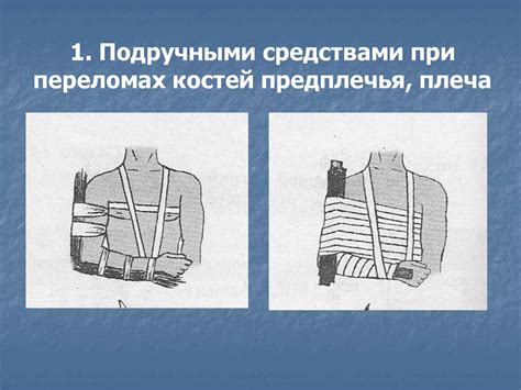 Способы иммобилизации верхних и нижних конечностей - презентация онлайн