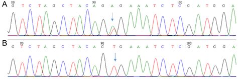 Representative Sequencing Of Exon 15 Of Braf A The V600e Gtg To Download Scientific Diagram