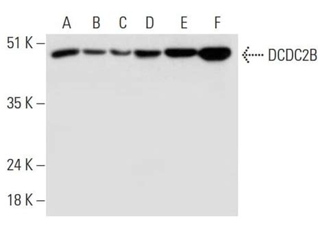 DCDC2B Antibody E 6 SCBT Santa Cruz Biotechnology