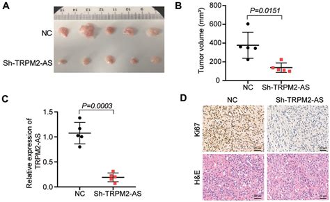 Lncrna Trpm2 As Promotes Ovarian Cancer Progression And Cisplatin