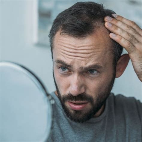 A Man S Guide To The Top Causes Of Hair Loss Lifestyle By Ps