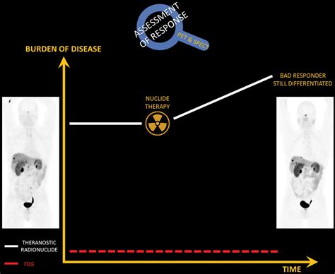 Theranostics In Nuclear Medicine Emerging And Re Emerging Integrated Imaging And Therapies In