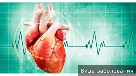 Нарушение сердечного ритма. Как лечить нарушение сердечного ритма ...