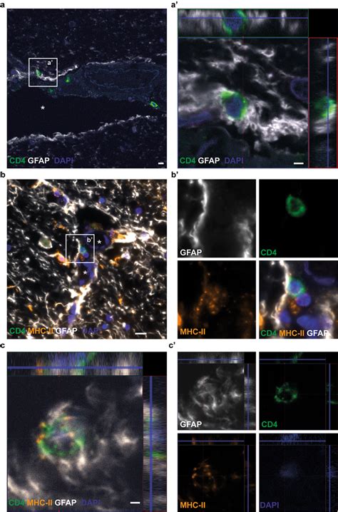 Mhc Ii Expressing Astrocytes Are Situated In Close Contact With Cd T