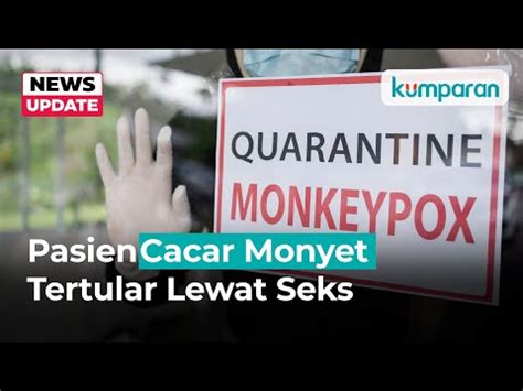 Terdapat Orang Pasien Cacar Monyet Di Ri Semuanya Tertular Lewat