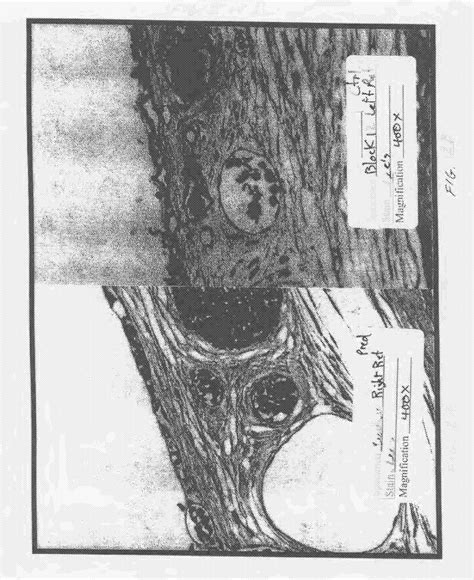 Hydrogels used to deliver medicaments to the eye for the treatment of