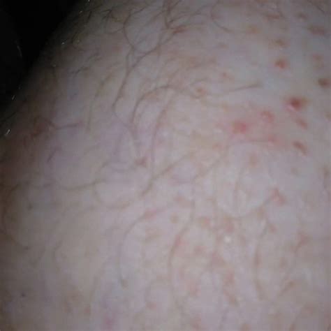 BBC Fucks My Huge Chub Ass Free Gay Chub Porn XHamster XHamster