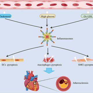 Multiple Risk Factors Contribute To Atherosclerosis By Inducing