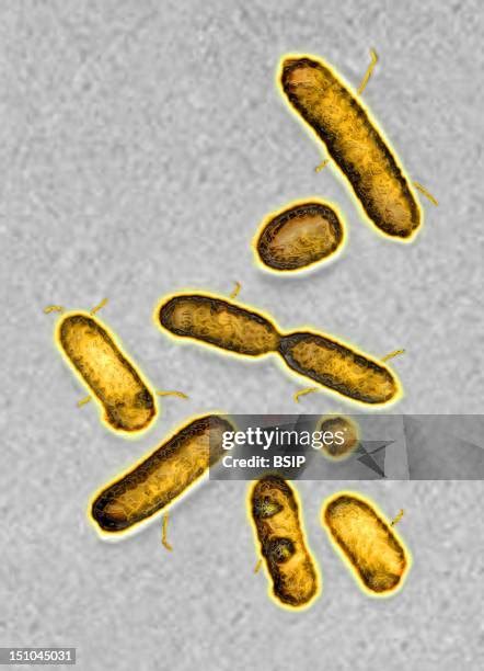 pseudomonas aeruginosa   premium high res pictures getty images