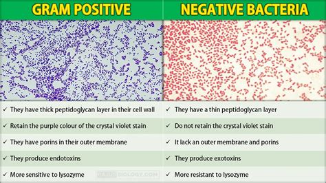 Difference Between Gram Positive And Gram Negative Bacteria Rajus Biology