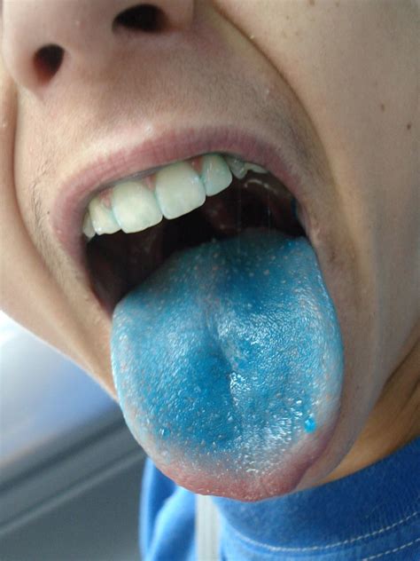 Blueberry Lollipop Tongue Melanie Flickr