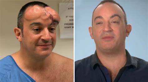 The Most Shocking 'Botched' Plastic Surgery Transformations