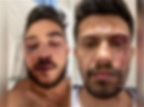 Cena de horror Casal gay brasileiro denuncia espancamento por seguranças em boate na Europa