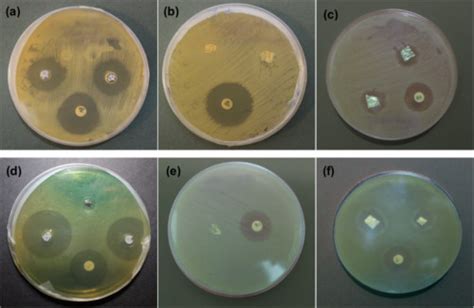 Inhibitory Effect Of Different Samples Against Staphylococcus Aureus