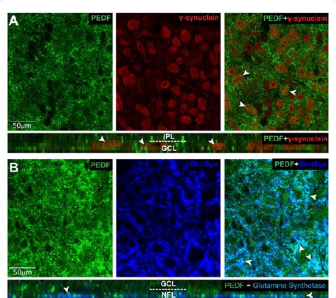 Pedf Is Associated With Rgcs And M Ller Cell Endfeet In The Ganglion