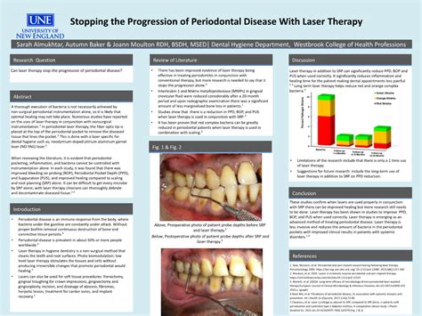 Stopping The Progression Of Periodontal Disease With Laser Therapy This