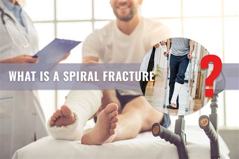 Spiral Fracture Symptoms Causes Treatment Er Of Mesquite