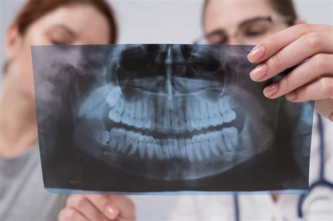 8 Signs Of Root Resorption And Resorbing Tooth