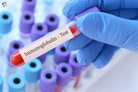 Immunoglobulin Test: Impact Of High Immunoglobulin Levels (IgA) | The ...