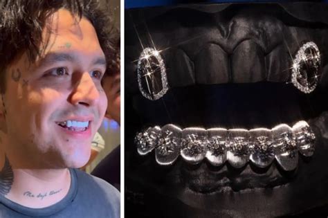 Nodal Estrena Dentadura De Oro Y Diamantes