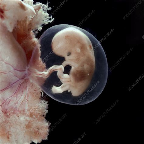 Human Foetus At 2 Months Stock Image C0599342 Science Photo Library