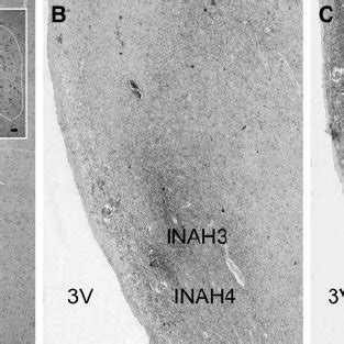 PDF A Sex Difference In The Hypothalamic Uncinate Nucleus Relationship To Gender Identity