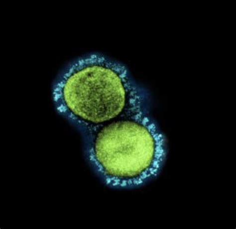Scientists Identify Interferon Gamma As Potential Sars Cov 2 Antiviral