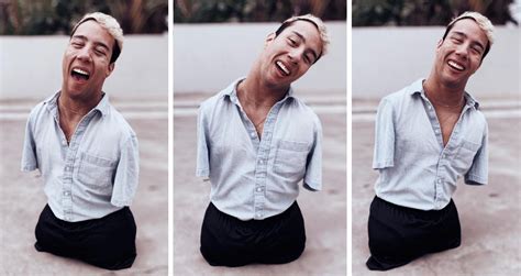 Un hombre gay que nació sin extremidades habla sobre su salida del armario CromosomaX