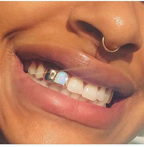 Pin By Nc Zna On Z Hne Teeth Jewelry Gold Teeth Gold Teeth Grills