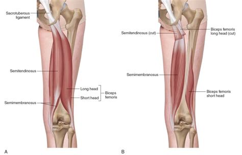 Hamstring Tendon Injury & Rehabilitation - Inertia Health Group Adelaide