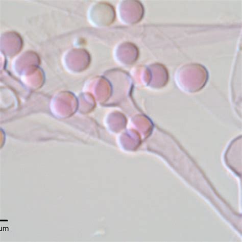 Single Sporangium And Sporangiospores Of Actinomucor Elegans Var