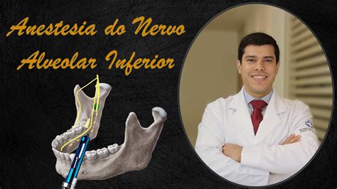 Anestesia Do Nervo Alveolar Inferior Braincp