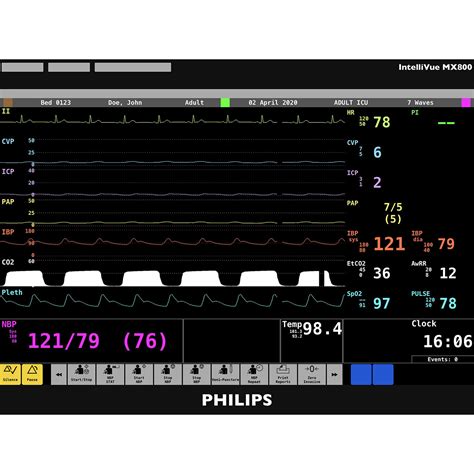 Philips Intellivue Mx800 Screen Simulation Vital Sign Simulation