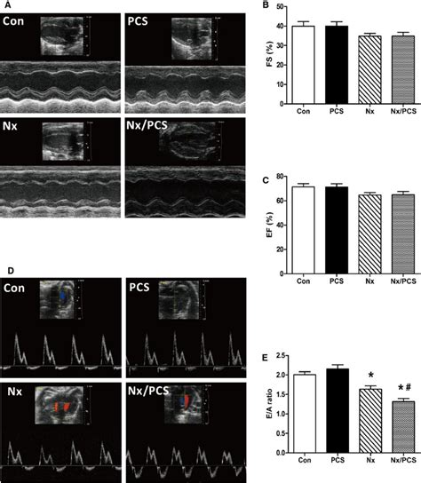 Functional Analysis Of The Left Ventricle With Echocardiography A