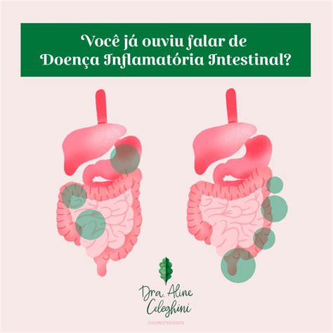 Coceira No Anus Em Crianças - Coceira no ânus, o que pode ser? Isso é normal? - Dra. Aline Celeghini ...