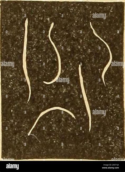 tapeworm segments  stool  carla armour blog
