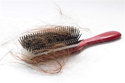 how to stop hair from falling out for men 8