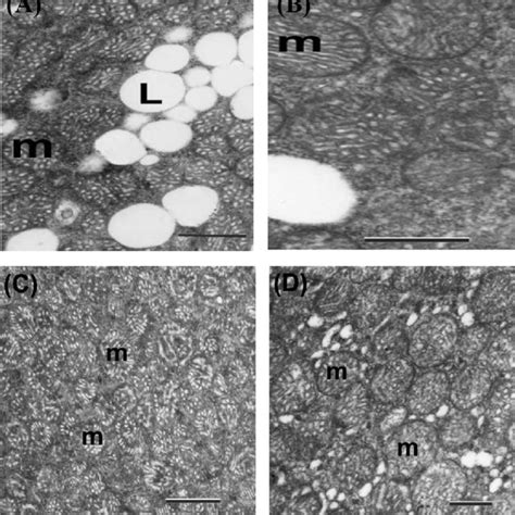 Transmission Electron Micrographs Of The Adrenal Cortex Of Mice A