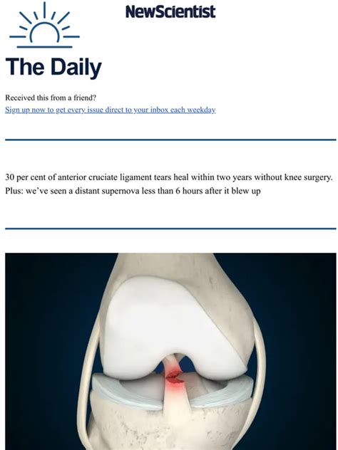 New Scientist Knee Ligament Injuries Heal Without Surgery Milled