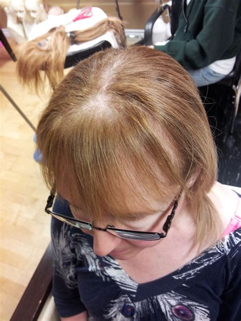 25 Hairstyles For Women With Thinning Hair On Crown Hairstyle Catalog