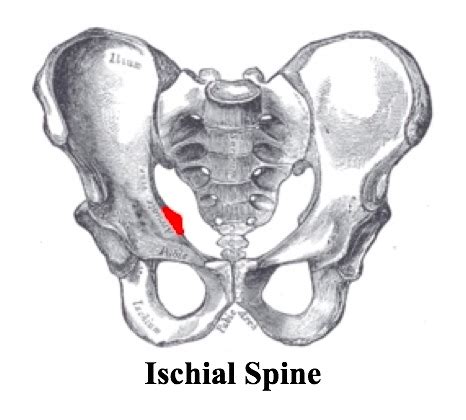 Back To Basics Pelvic Xrays — Taming The Sru