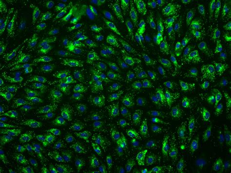 The Many Faces of Hepatic Sinusoidal Endothelial Cells - ScienCell Research Laboratories