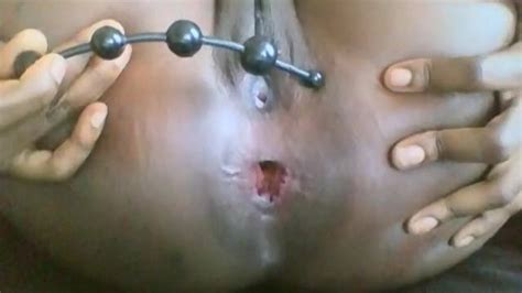 Anal Ass Gaping Pornhub