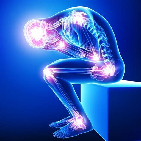 acute pain artofit