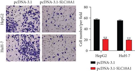 Slc A Expressed Lowly In Hcc Cells And Suppressed Its Proliferation